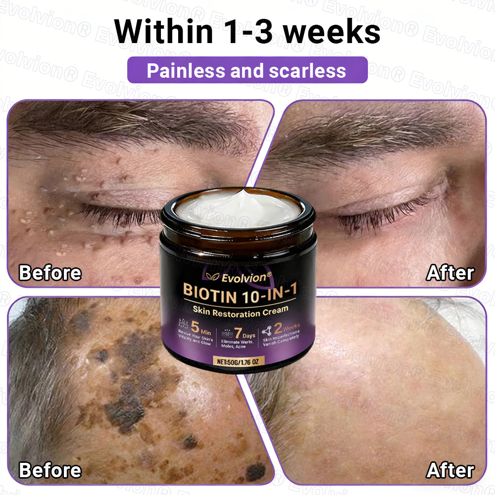 Made and Shipped from Australia ✨ Evolvion® Biotin 10-in-1 Skin Restoration Cream 🚀
