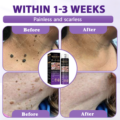 Made and Shipped from Australia ✨Evolvion® Biotin 10-in-1 Skin Restoration Spray 🔥