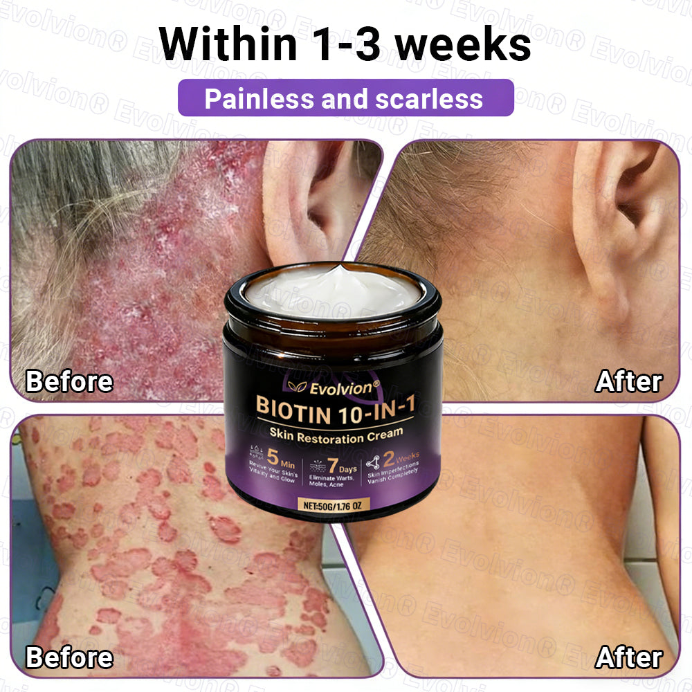Made and Shipped from Australia ✨ Evolvion® Biotin 10-in-1 Skin Restoration Cream 🚀