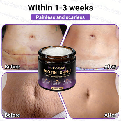 Made and Shipped from Australia ✨ Evolvion® Biotin 10-in-1 Skin Restoration Cream 🚀