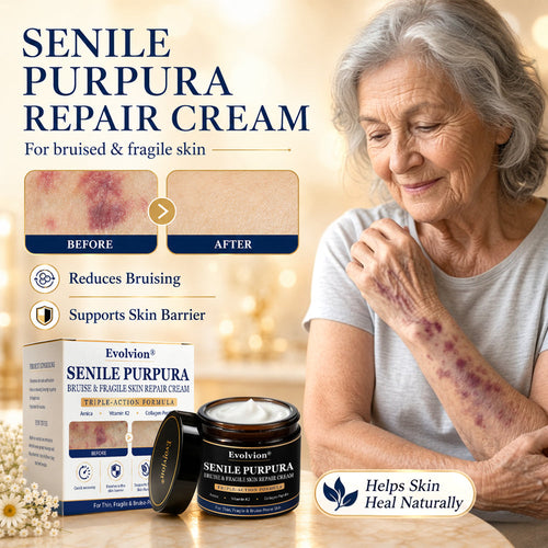 ✨Evolvion® Senile Purpura, Bruise & Fragile Skin Repair Cream🌿