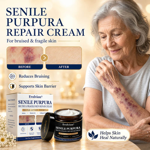 ✨Evolvion® Senile Purpura, Bruise & Fragile Skin Repair Cream🌻