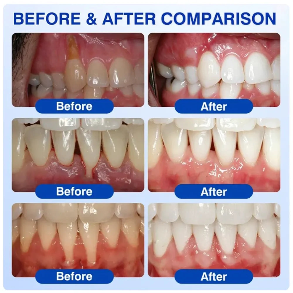 Pheromex® 🦷GumRevive Periodontal Care Gel