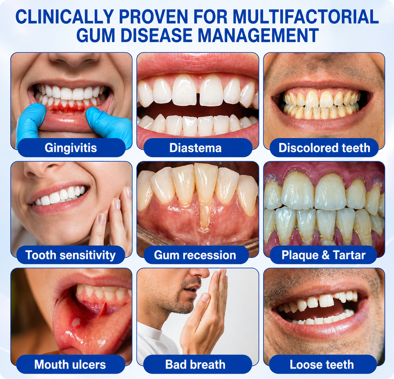 Pheromex® 🦷GumRevive Periodontal Care Gel