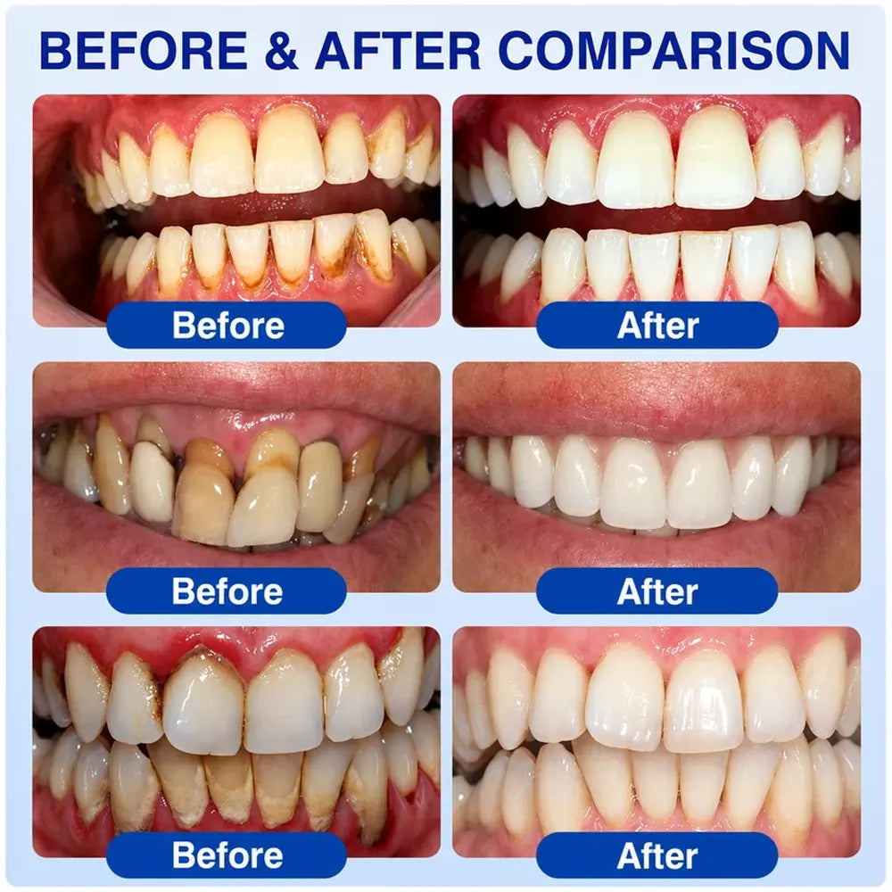 Pheromex® 🦷GumRevive Periodontal Care Gel