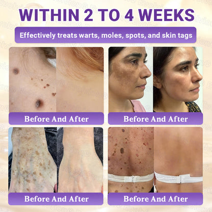 Made and Shipped from Australia ✨ Evolvion® Biotin 10-in-1 Skin Restoration Cream 🚀