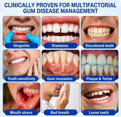Pheromex® 🦷GumRevive Periodontal Care Gel