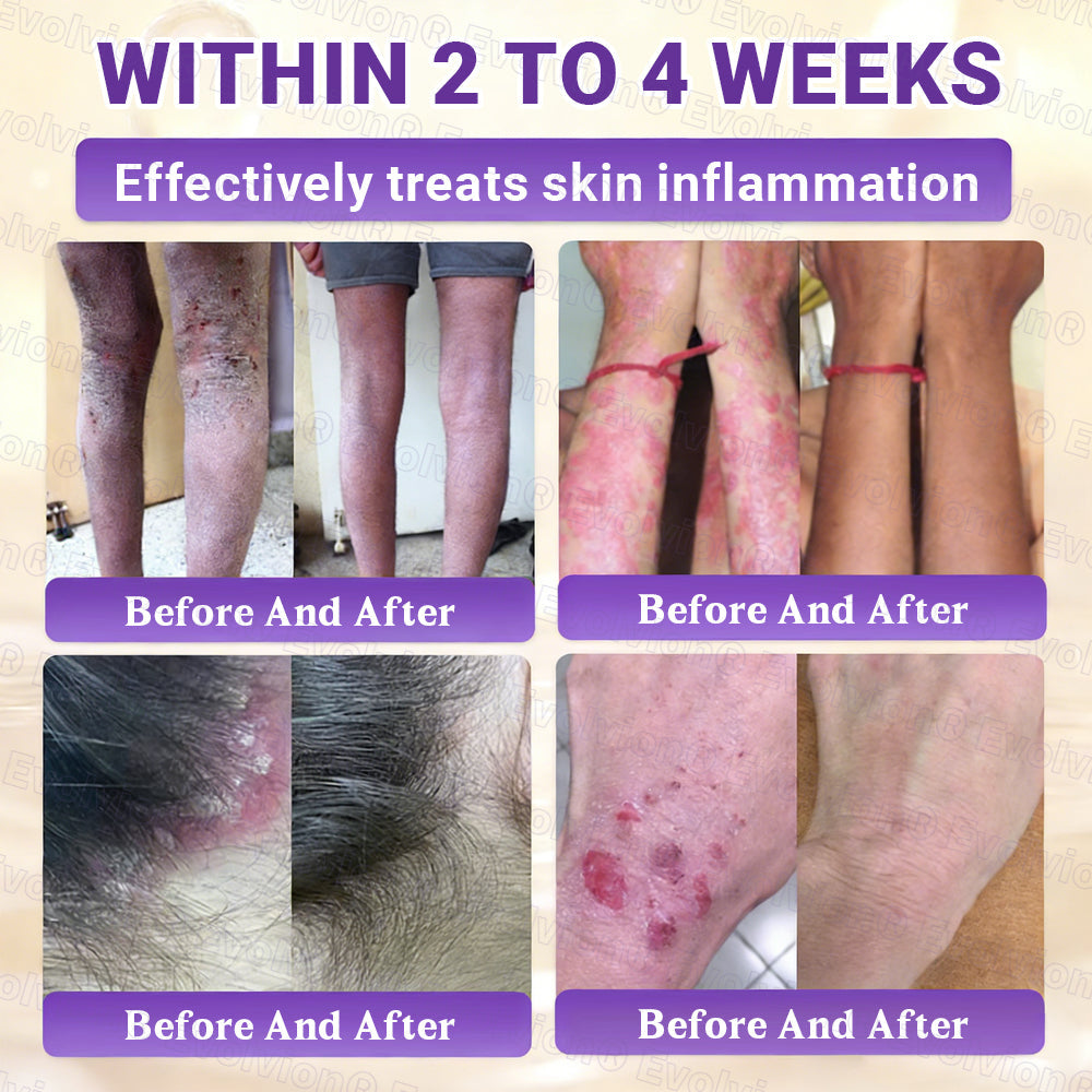 Made and Shipped from Australia ✨ Evolvion® Biotin 10-in-1 Skin Restoration Cream 🚀