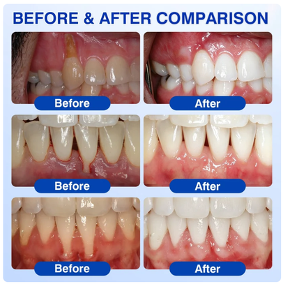 Pheromex® 🦷GumRevive Periodontal Care Gel