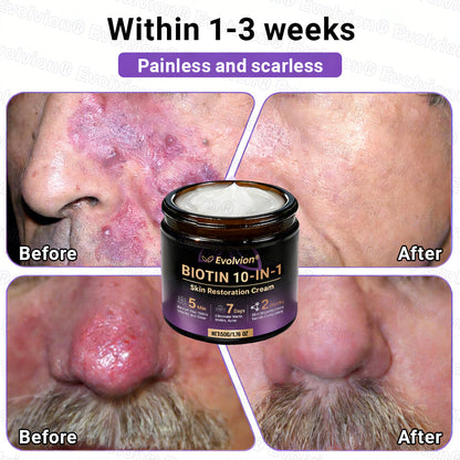 Made and Shipped from Australia ✨ Evolvion® Biotin 10-in-1 Skin Restoration Cream 🚀