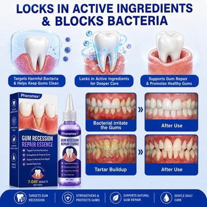 Pheromex® 🦷GumRevive Periodontal Care Gel
