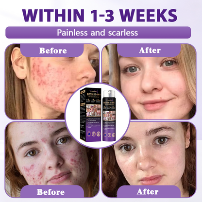 Made and Shipped from Australia ✨Evolvion® Biotin 10-in-1 Skin Restoration Spray 🔥