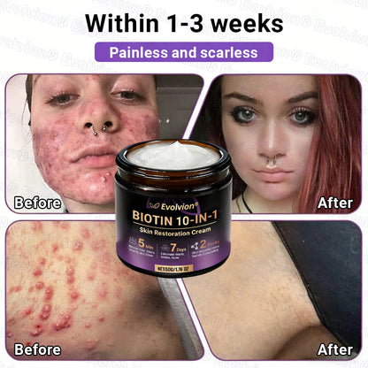 Made and Shipped from Australia ✨ Evolvion® Biotin 10-in-1 Skin Restoration Cream 🚀