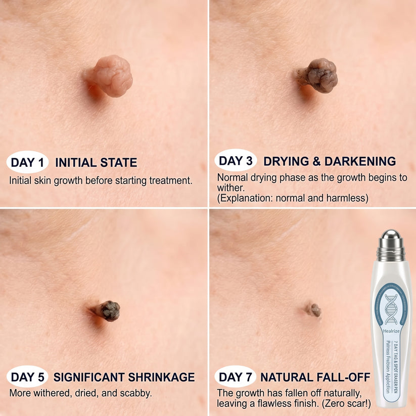Evolvion® Precision Skin Tag Care Pen product image 8