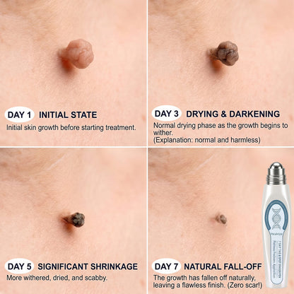 Evolvion® Precision Skin Tag Care Pen product image 8
