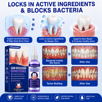 Pheromex® 🦷GumRevive Periodontal Care Gel