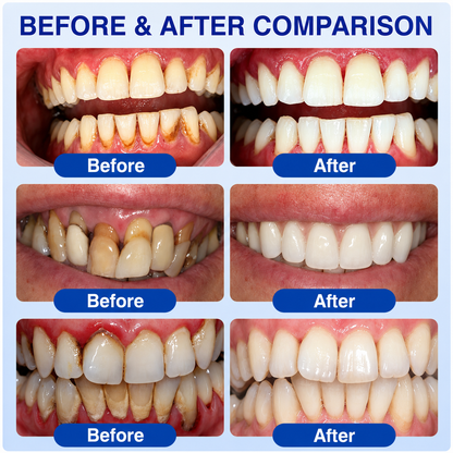 Pheromex® 🦷GumRevive Periodontal Care Gel
