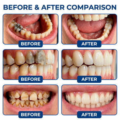 Dr.Fachmer® DentRestore Tooth Repair & Filling System🎯