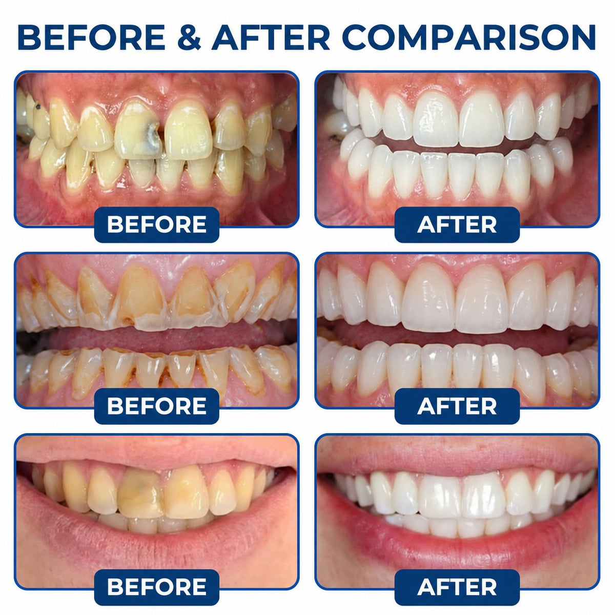 Dr.Fachmer® DentRestore Tooth Repair & Filling System🎯
