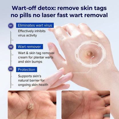 Evolvion® Precision Skin Tag Care Pen - BUY 4 GET 4 FREE: Best Value Supply